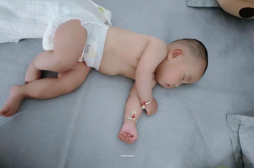 营口宝宝头上长痱子